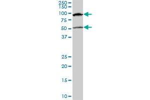 MECP2 monoclonal antibody (M01), clone 4B6. (MECP2 anticorps  (AA 81-170))
