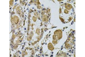 Immunohistochemistry of paraffin-embedded Human stomach using Cyclin A2 Polyclonal Antibody at dilution of 1:100 (40x lens). (Cyclin A anticorps)