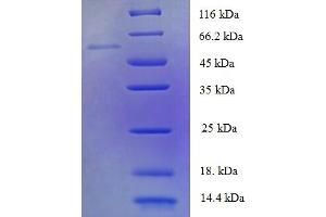 SDS-PAGE (SDS) image for Pyruvate Dehyrogenase Phosphatase Catalytic Subunit 2 (PDP2) (AA 67-529) protein (His tag) (ABIN5711819)