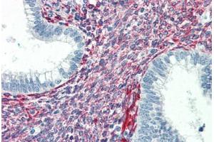 Human Uterus (formalin-fixed, paraffin-embedded) stained with SERPINH1 antibody ABIN364502 at 5 ug/ml followed by biotinylated anti-mouse IgG secondary antibody ABIN481714, alkaline phosphatase-streptavidin and chromogen. (SERPINH1 anticorps)