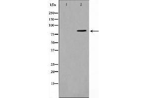 Western blot analysis of STAT1 expression in COLO205 whole cell lysates,The lane on the left is treated with the antigen-specific peptide. (STAT1 anticorps)