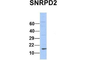Host:  Rabbit  Target Name:  SNRPD2  Sample Type:  Human 293T  Antibody Dilution:  1. (SNRPD2 anticorps  (Middle Region))