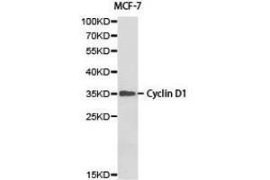 Western blot analysis of MCF-7 cell lysate ,using Cyclin D1 antibody. (Cyclin D1 anticorps)