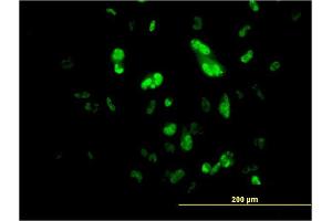 Immunofluorescence of monoclonal antibody to FOXA2 on HepG2 cell. (FOXA2 anticorps  (AA 363-457))