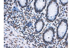 Image no. 7 for anti-ATP Synthase, H+ Transporting, Mitochondrial F1 Complex, beta Polypeptide (ATP5B) antibody (ABIN1496766)