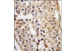 Formalin-fixed and paraffin-embedded human testis tissue reacted with PUM1 Antibody (C-term), which was peroxidase-conjugated to the secondary antibody, followed by DAB staining. (PUM1 anticorps  (N-Term))