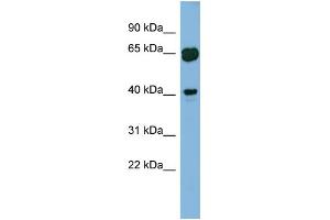 WB Suggested Anti-RAB3IL1 Antibody Titration: 0. (RAB3IL1 anticorps  (Middle Region))