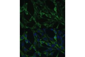 Immunofluorescence analysis of NIH-3T3 cells using CALU antibody (ABIN6129533, ABIN6137878, ABIN6137880 and ABIN6222201) at dilution of 1:100.