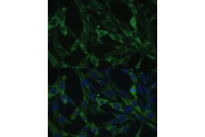 Immunofluorescence analysis of NIH-3T3 cells using CALU antibody (ABIN6129533, ABIN6137878, ABIN6137880 and ABIN6222201) at dilution of 1:100. (CALU anticorps  (AA 20-315))