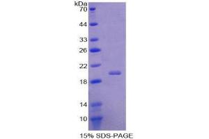 SDS-PAGE (SDS) image for Acid Phosphatase 1, Soluble (ACP1) (AA 1-158) protein (His tag) (ABIN1078718)