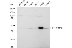 Western blotting analysis using AGTR2 antibody (ABIN7797607).