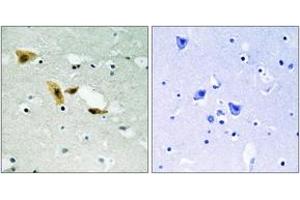 Immunohistochemistry analysis of paraffin-embedded human brain tissue, using APLF (Ab-116) Antibody. (APLF anticorps  (AA 82-131))