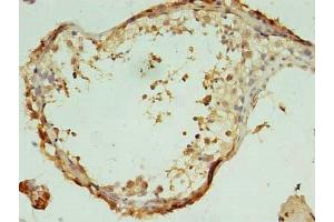 Immunohistochemistry of paraffin-embedded human testis tissue using ABIN7171818 at dilution of 1:100 (Testis-Expressed Protein 47 (TEX47) (AA 1-253) anticorps)