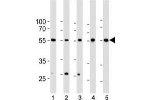Western blot analysis of lysate from 1) HeLa, 2) K562, 3) MCF-7 cell line, 4) human liver and 5) mouse liver tissue lysate using BMPR1A antibody at 1:1000. (BMPR1A anticorps  (AA 1-30))