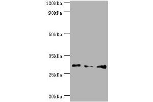 Western blot All lanes: Homeobox protein Hox-B5 antibody at 8 μg/mL Lane 1: HepG2 whole cell lysate Lane 2: Rat liver tissue Lane 3: Rat lung tissue Secondary Goat polyclonal to rabbit IgG at 1/10000 dilution Predicted band size: 29 kDa Observed band size: 29 kDa (HOXB5 anticorps  (AA 1-170))
