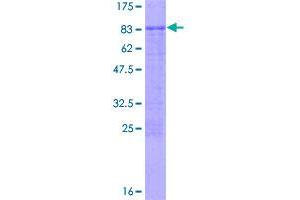 Image no. 1 for Pleiomorphic Adenoma Gene-Like 2 (PLAGL2) (AA 1-496) protein (GST tag) (ABIN1315315)