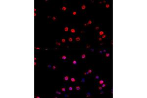 Immunofluorescence analysis of R. (PD-L1 anticorps  (AA 19-238))