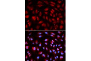 Immunofluorescence analysis of U2OS cells using PLK1 antibody. (PLK1 anticorps)