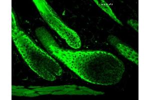 Immunohistochemistry analysis using Rabbit Anti-HSP70 Polyclonal Antibody (ABIN361820 and ABIN361821). (HSP70 anticorps)