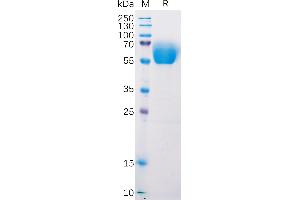 Mouse BTLA Protein, mFc Tag on SDS-PAGE under reducing condition.