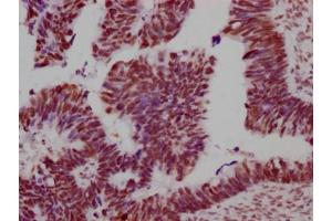 anti-Structural Maintenance of Chromosomes 1A (SMC1A) antibody