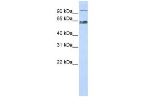 WB Suggested Anti-KIAA0892 Antibody Titration: 0.