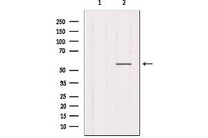 Western blot analysis of extracts from Mouse muscle, using CHRNG Antibody.