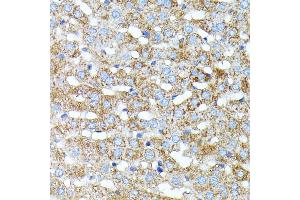 Immunohistochemistry of paraffin-embedded rat liver using Haptoglobin (Haptoglobin (HP)) antibody (ABIN3022157, ABIN3022158, ABIN1513029, ABIN1514188 and ABIN6218636) at dilution of 1:100 (40x lens). (Haptoglobin anticorps)