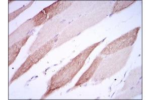 Immunohistochemistry (IHC) image for anti-Activated Leukocyte Cell Adhesion Molecule (ALCAM) (AA 405-524) antibody (ABIN1846220)