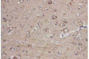Anti-Eph receptor A1 antibody, IHC(P) IHC(P): Rat Brain Tissue (EPHA1 anticorps  (C-Term))
