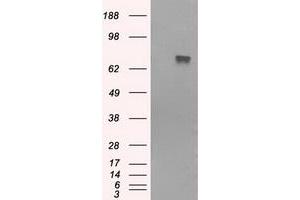 Western Blotting (WB) image for anti-Bruton Agammaglobulinemia tyrosine Kinase (BTK) antibody (ABIN1496971) (BTK anticorps)