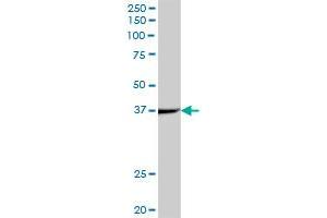 anti-Acyl-CoA Dehydrogenase, C-2 To C-3 Short Chain (Acads) (AA 1-412) antibody