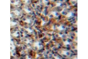 Used in DAB staining on fromalin fixed paraffin-embedded Kidney tissue
