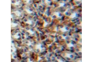Used in DAB staining on fromalin fixed paraffin-embedded Kidney tissue (Vitamin D-Binding Protein anticorps  (AA 17-476))