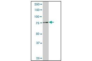 Western Blotting (WB) image for anti-SMAD Specific E3 Ubiquitin Protein Ligase 1 (SMURF1) antibody (ABIN781919)