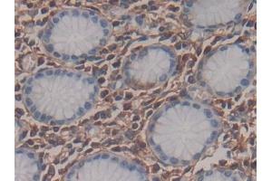 Detection of MEAI in Human Stomach Tissue using Polyclonal Antibody to Menin (MEAI)