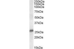 ABIN185347 (0. (SRD5A2 anticorps  (N-Term))
