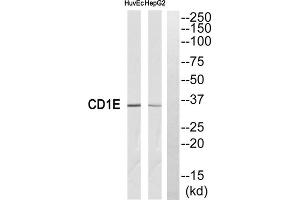 Western blot analysis of extracts from HuvEc cells and HepG2 cells, using CD1E antibody. (CD1e anticorps  (Internal Region))