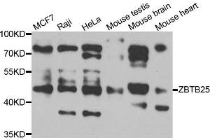 Western blot analysis of extracts of various cell lines, using ZBTB25 antibody. (ZBTB25 anticorps)