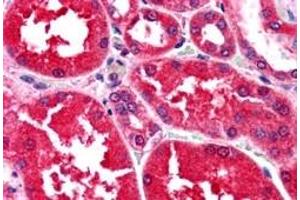 Immunohistochemistry (IHC) image for anti-Aldo-Keto Reductase Family 1, Member B1 (Aldose Reductase) (AKR1B1) antibody (ABIN5912019) (AKR1B1 anticorps)