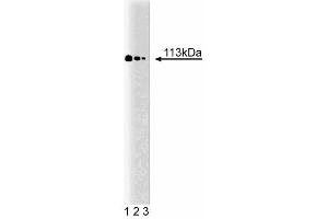 Western blot analysis of Stat2 on a K-562 cell lysate (Human bone marrow myelogenous leukemia, ATCC CCL-243). (STAT2 anticorps  (AA 1-178))