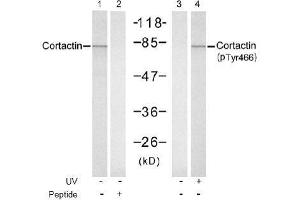Image no. 1 for anti-Cortactin (CTTN) (pTyr466) antibody (ABIN197036) (Cortactin anticorps  (pTyr466))
