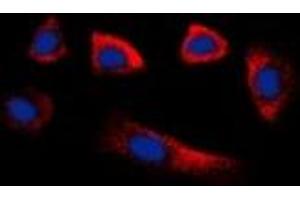 Immunofluorescent analysis of Glycerate Kinase staining in HepG2 cells. (GLYCTK anticorps)