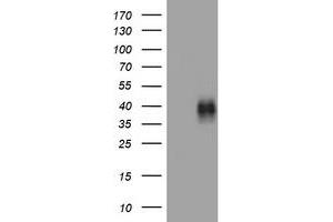 Image no. 1 for anti-Tumor Necrosis Factor Receptor Superfamily, Member 9 (TNFRSF9) (AA 24-186) antibody (ABIN1491247) (CD137 anticorps  (AA 24-186))