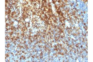 Formalin-fixed, paraffin-embedded human Tonsil stained with CD43 Rabbit Recombinant Monoclonal Antibody (SPN/1766R).