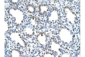 SLC15A4 antibody was used for immunohistochemistry at a concentration of 4-8 ug/ml. (SLC15A4 anticorps  (N-Term))