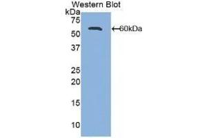 Detection of Recombinant ALCAM, Mouse using Polyclonal Antibody to Activated Leukocyte Cell Adhesion Molecule (ALCAM) (CD166 anticorps  (AA 28-527))