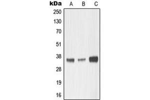 Western blot analysis of MMP23 expression in HepG2 (A), mouse kidney (B), rat kidney (C) whole cell lysates. (Matrix Metallopeptidase 23 (MMP23) (Center) anticorps)