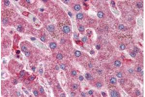 Liver: Formalin-Fixed, Paraffin-Embedded (FFPE) (HYAL1 anticorps  (AA 325-339))