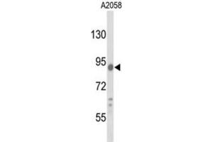 Western Blotting (WB) image for anti-Component of Oligomeric Golgi Complex 4 (COG4) antibody (ABIN3003206) (COG4 anticorps)